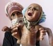 Oxfam Scott Paul on the humanitarian crisis in Yemen