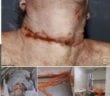 Epstein Photos show he was murdered